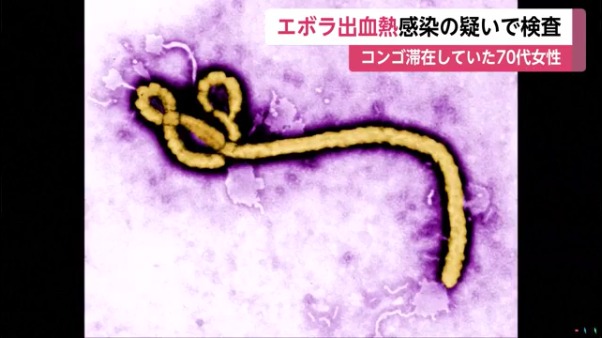 エボラ出血熱の感染経路と感染予防
