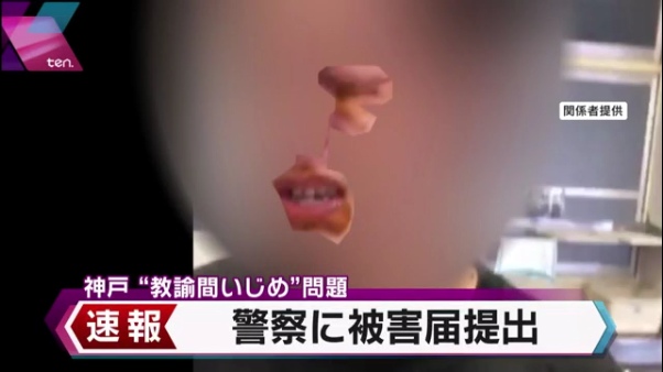東須磨小学校 教員間暴行で被害男性側が被害届提出