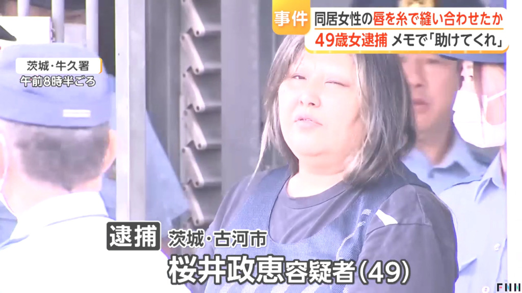 桜井政恵を傷害で逮捕 古河市諸川の自宅で42歳の同居女性の唇を針と糸で縫い付ける